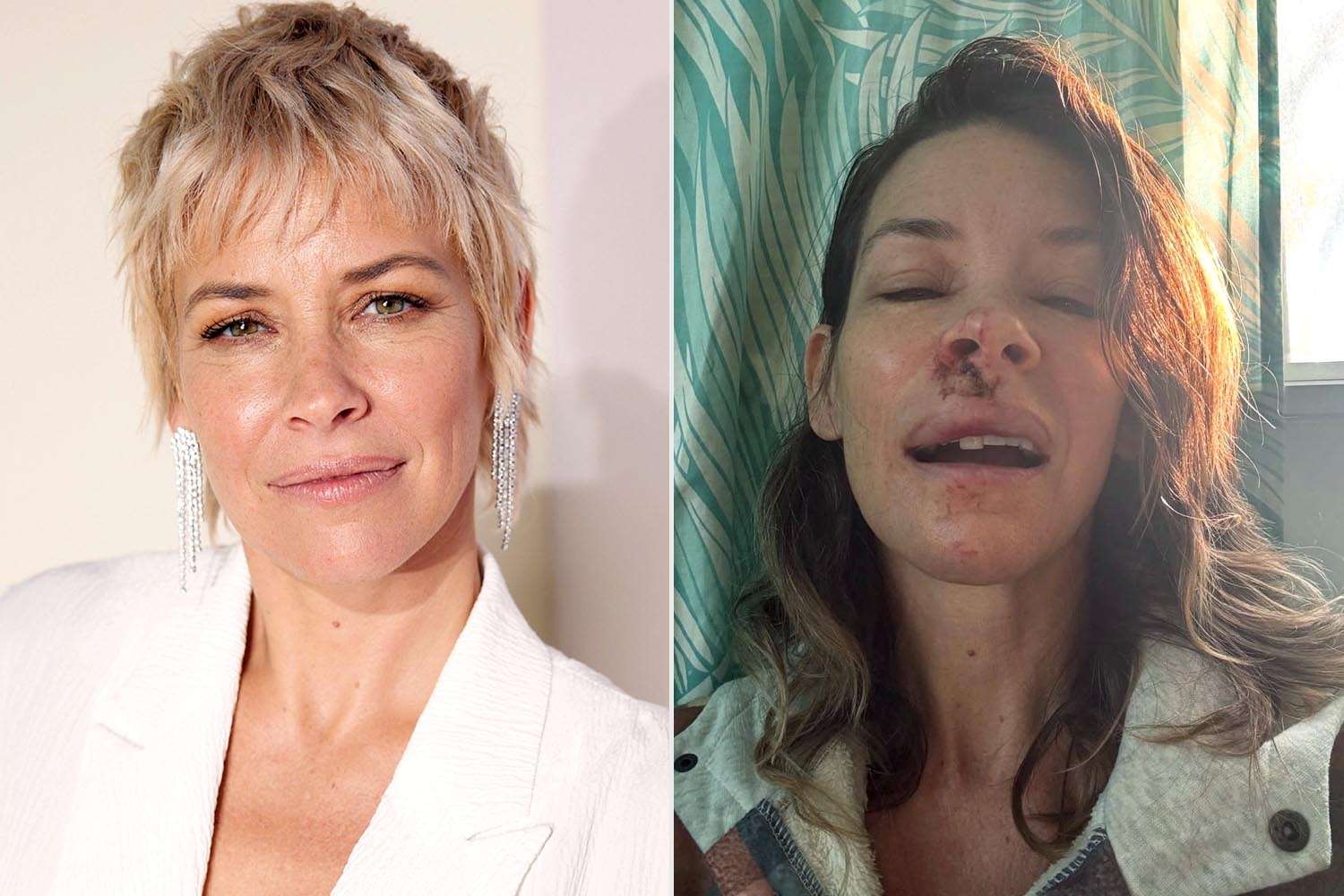 Evangeline Lilly dezvăluie că suferă de leziuni cerebrale în urma unei concuzii Actrița Evangeline Lilly, cunoscută din producții de succes precum „Lost” și „Ant-Man and the Wasp”, a publicat recent un videoclip pe Instagram în care a împărtășit vești îngrijorătoare despre starea sa de sănătate