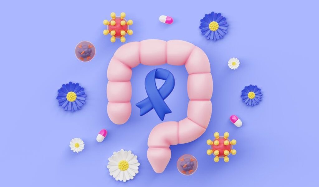 Cancerul colorectal: Cum poți reduce riscul prin schimbări simple în stilul de viață Cancerul colorectal, una dintre cele mai răspândite forme de cancer, poate fi prevenit în multe cazuri prin adoptarea unor obiceiuri sănătoase
