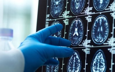 O nouă hartă detaliată a îmbătrânirii creierului dezvăluie vulnerabilități genetice Îmbătrânirea creierului nu este un proces unitar, iar cercetătorii au identificat pentru prima dată o hartă detaliată a modului în care factorii genetici influențează acest fenomen