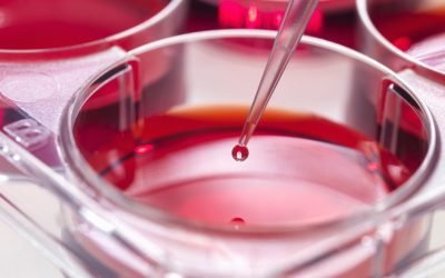 Opțiuni:

Cercetătorii, descoperire cheie: Mecanism anti-leucemie agresivă. (59 caractere)
Leucemie agresivă: Știința identifică potențială armă de combatere. (61 caractere)
Nouă speranță: Mecanism identificat pentru stoparea leucemiei severe. (65 caractere)
Leucemie: Cercetătorii au identificat o posibilă cale de blocare. (63 caractere)