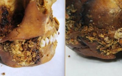 O femeie scită supraviețuiește unei intervenții chirurgicale complexe, acum 2.500 de ani O descoperire arheologică uluitoare dezvăluie o intervenție chirurgicală complexă și o proteză primitivă, efectuate acum 2.500 de ani, pe o femeie scită din Siberia