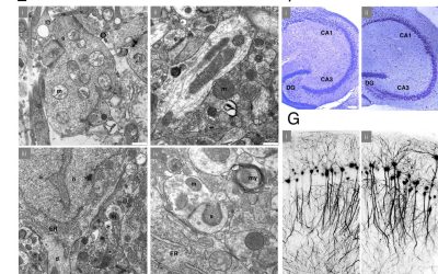 Noi experimente: Creier crioconservat, readus la viață?