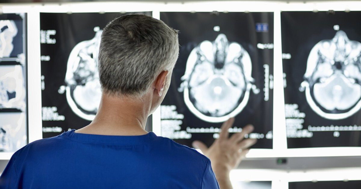 Poluarea aerului, un nou inamic: crește riscul de Alzheimer Un studiu recent, realizat pe un eșantion vast de peste 27 de milioane de persoane, scoate în evidență o legătură îngrijorătoare între poluarea aerului și apariția bolii Alzheimer
