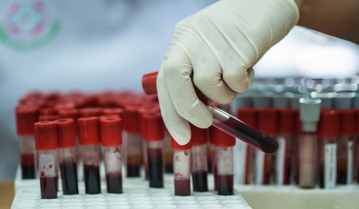 Controale medicale: Ce analize sunt recomandate la 25, 35 și 45 de ani pentru prevenție Medicii recomandă un calendar precis de controale medicale, adaptat vârstei, pentru a detecta din timp posibilele afecțiuni