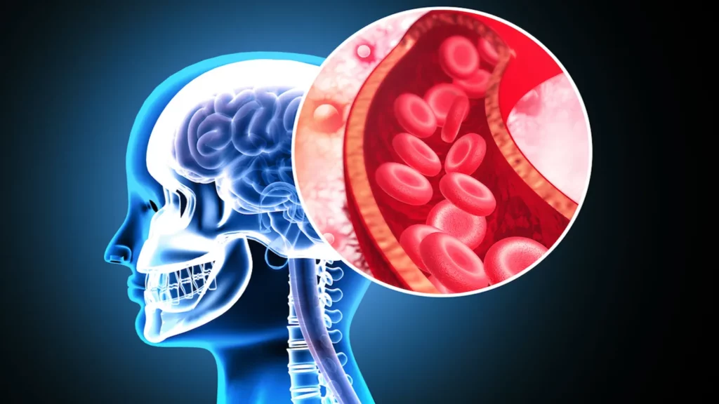Supliment: Scade riscul de infarct și AVC cu până la 43%