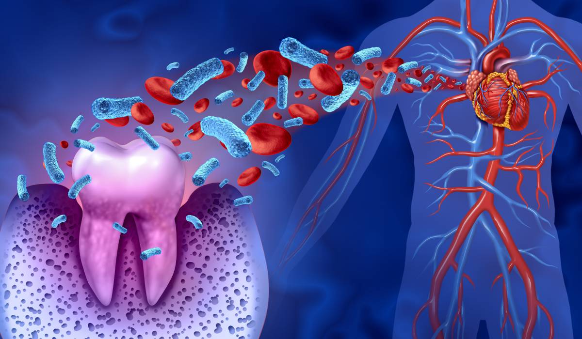 Afecțiunile cardiovasculare și sănătatea orală: o legătură adesea neglijată Pacienții cu probleme cardiace pot fi mai predispuși la afecțiuni stomatologice, dar și invers este valabil, potrivit medicilor