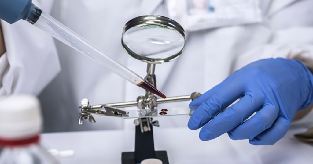 Top 5 invenții medicale care au salvat milioane de vieți De la vaccinuri la insulină, descoperirile medicale au schimbat cursul istoriei, salvând vieți și îmbunătățind calitatea vieții pentru milioane de oameni