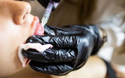 Vin cu mamele: Tinerele își măresc buzele cu ajutorul lor