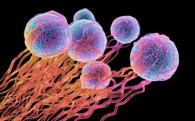 Microplasticul, legat de cancerul de prostată? Un studiu ridică semne de întrebare Un studiu recent, realizat de cercetători de la NYU Langone Health, a scos la iveală o posibilă legătură între expunerea la microplastic și dezvoltarea cancerului de prostată