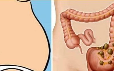 Deficiențe de vitamine, o cauză ascunsă a constipației