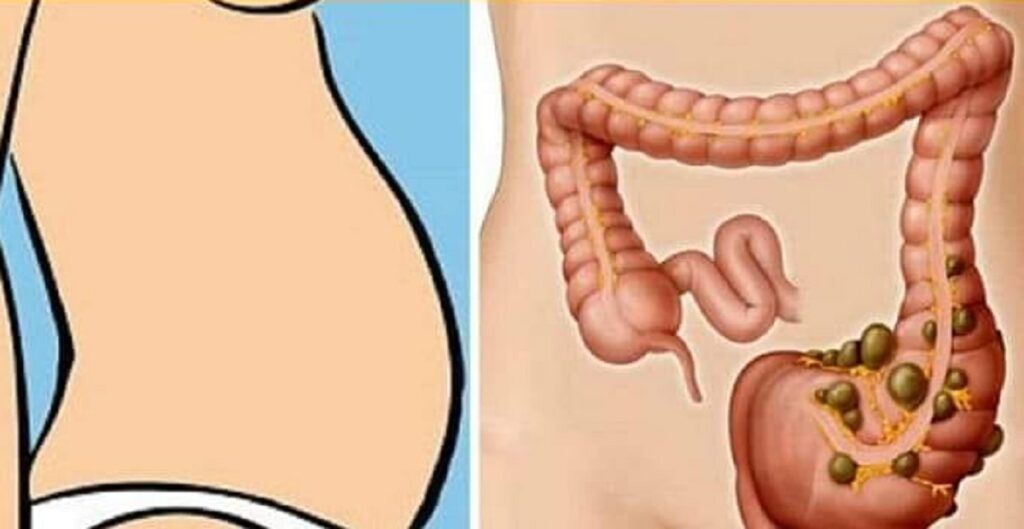 Deficiențe de vitamine, o cauză ascunsă a constipației