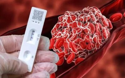 Noua variantă COVID „Cicada” se răspândește rapid în SUA și ridică semne de întrebare O nouă variantă COVID-19, denumită „Cicada” (BA.3.2), generează îngrijorare în Statele Unite, unde s-a răspândit rapid, fiind detectată deja în 29 de state