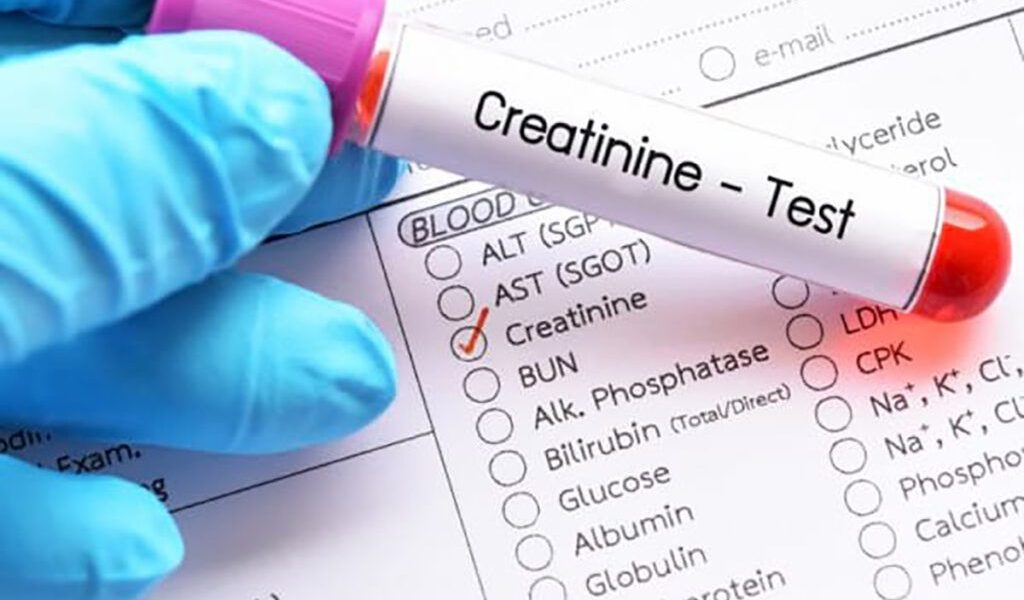 Dr. Iancu Cezar despre creatinină: Ce indică analiza renală