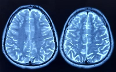 Neuroni umani, conectați la cipuri de siliciu, antrenați să joace Doom Un pas important spre dezvoltarea calculatoarelor biologice programabile a fost realizat de o echipă de cercetători