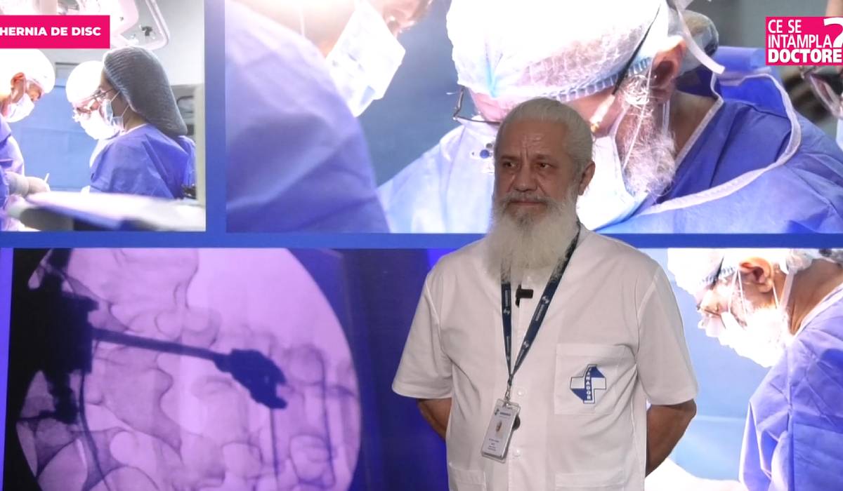 Durerea de spate, o problemă frecventă cu potențial grav Durerea de spate, resimțită de mulți oameni la nivel global, poate ascunde uneori o afecțiune mai serioasă: hernia de disc