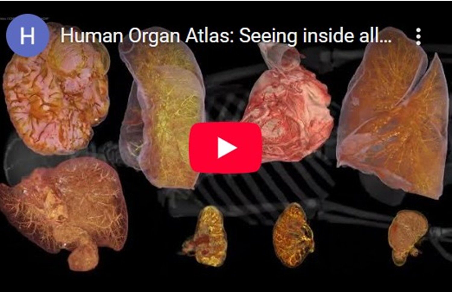 Atlasul corpului uman 3D: O fereastră digitală spre anatomie, cu aplicații revoluționare în medicină Un atlas digital interactiv al corpului uman, realizat după șase ani de cercetare de un consorțiu internațional, oferă o perspectivă detaliată asupra organelor interne, permițând vizualizări 3D și acces la date complexe