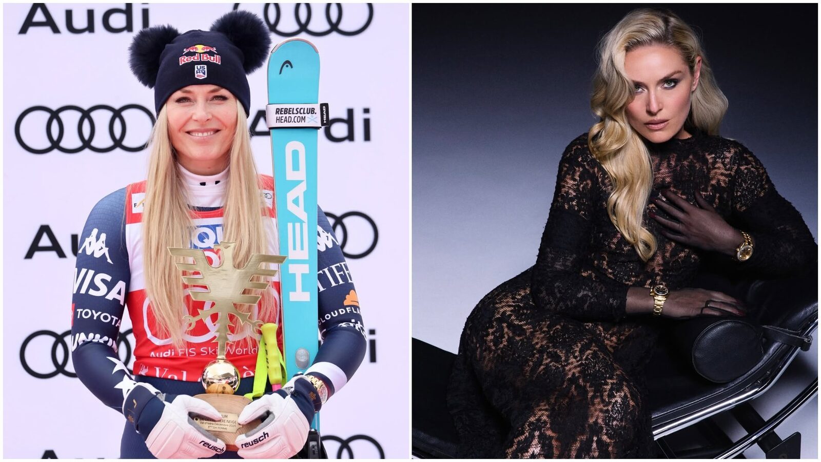 Lindsey Vonn, după accidentarea de la Jocurile Olimpice: Cum se recuperează schioarea americană Fosta campioană olimpică la schi alpin, Lindsey Vonn, a fost externată din spital și a început recuperarea după accidentarea suferită la Jocurile Olimpice de iarnă