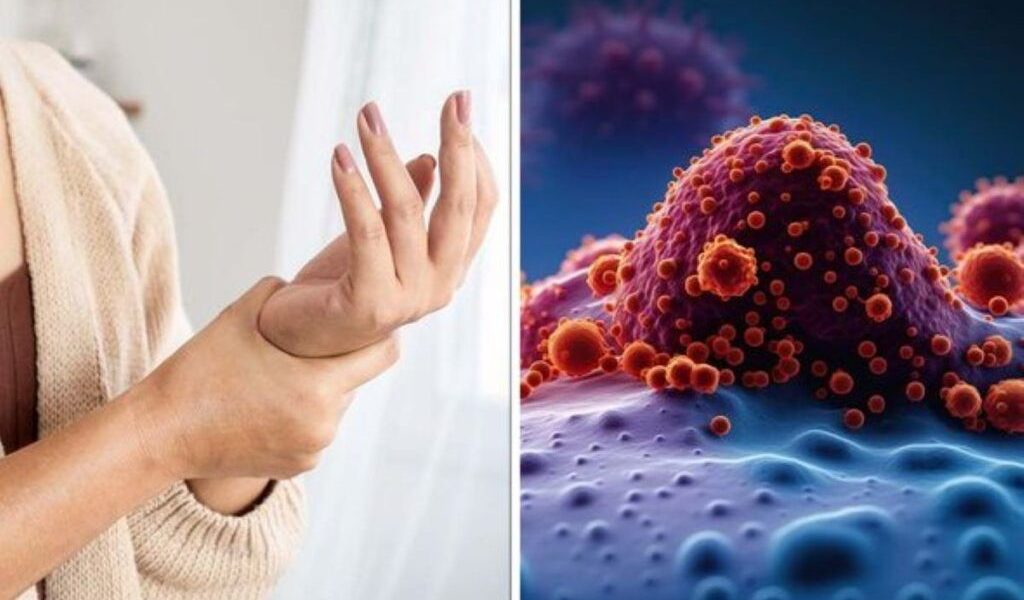 Semne banale ce pot indica cancer: Mergeți la medic