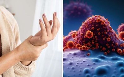 Semne banale ce pot indica cancer: Mergeți la medic