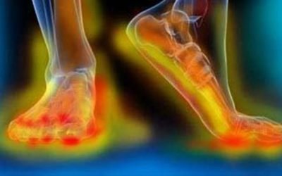 Dureri de picioare și amorțeală? Semne de avertizare ale diabetului, care pot duce la complicații grave Durerile persistente la nivelul picioarelor, furnicăturile sau senzația de amorțeală nu trebuie ignorate, mai ales dacă suferi de diabet