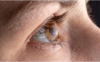 O cornee artificială, creată din solzi de pește, oferă speranțe pentru tratarea afecțiunilor oculare O echipă de cercetători de la Universitatea din Granada, Spania, a dezvoltat o cornee artificială dintr-o sursă neașteptată: solzii de pește