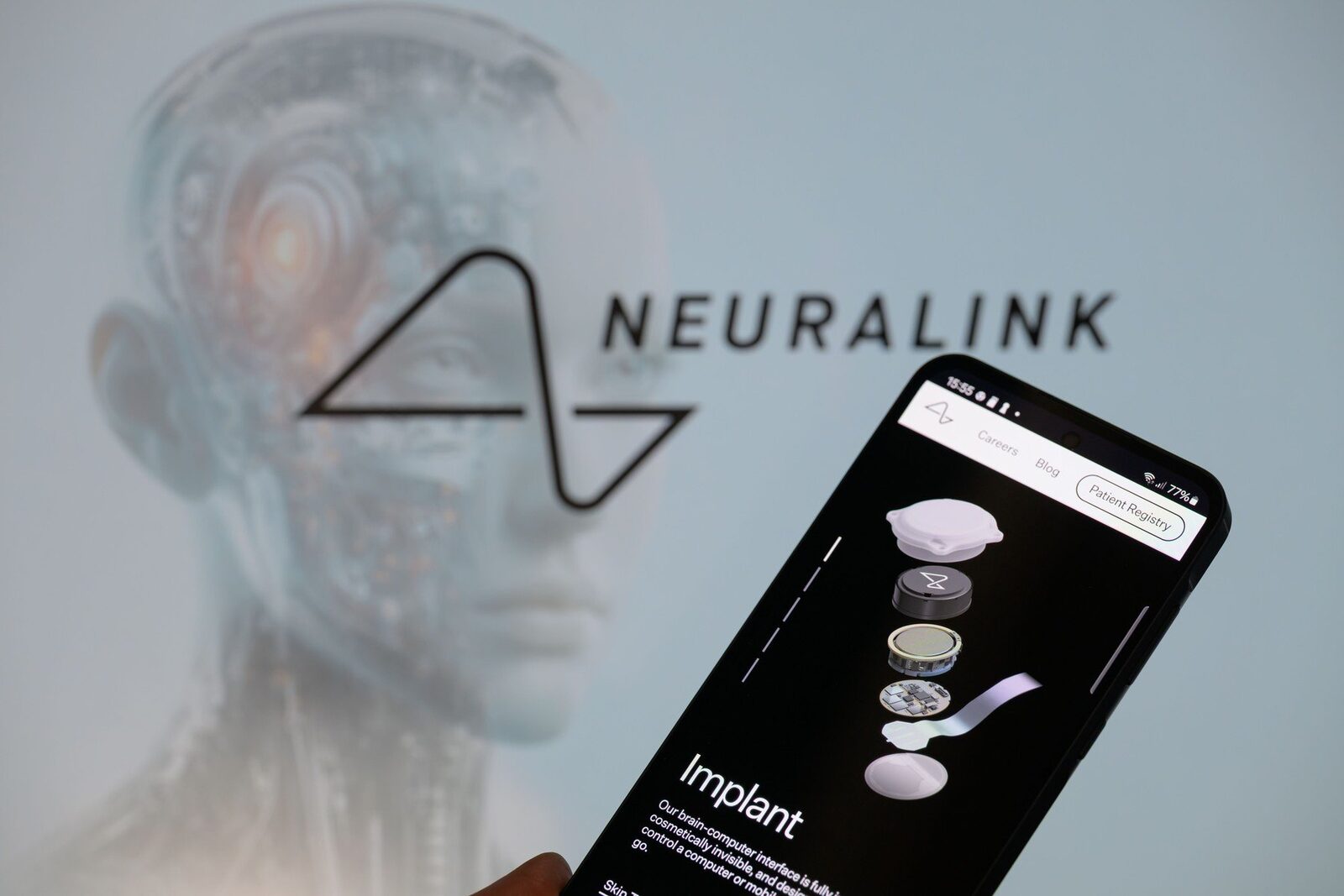 China aprobă primul implant cerebral comercial, o lovitură pentru Neuralink Beijingul a dat undă verde pentru comercializarea primului dispozitiv medical de interfață creier-computer (BCI) care se implantează în craniu, o realizare importantă pentru industria biomedicală chineză