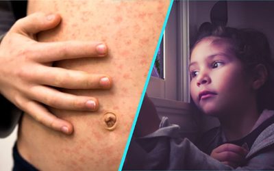 Alertă de sănătate: Rujeola ajunge în Noua Zeelandă după un zbor internațional Un nou focar de rujeolă a generat îngrijorare în Noua Zeelandă, după ce doi pasageri infectați au călătorit cu un zbor internațional