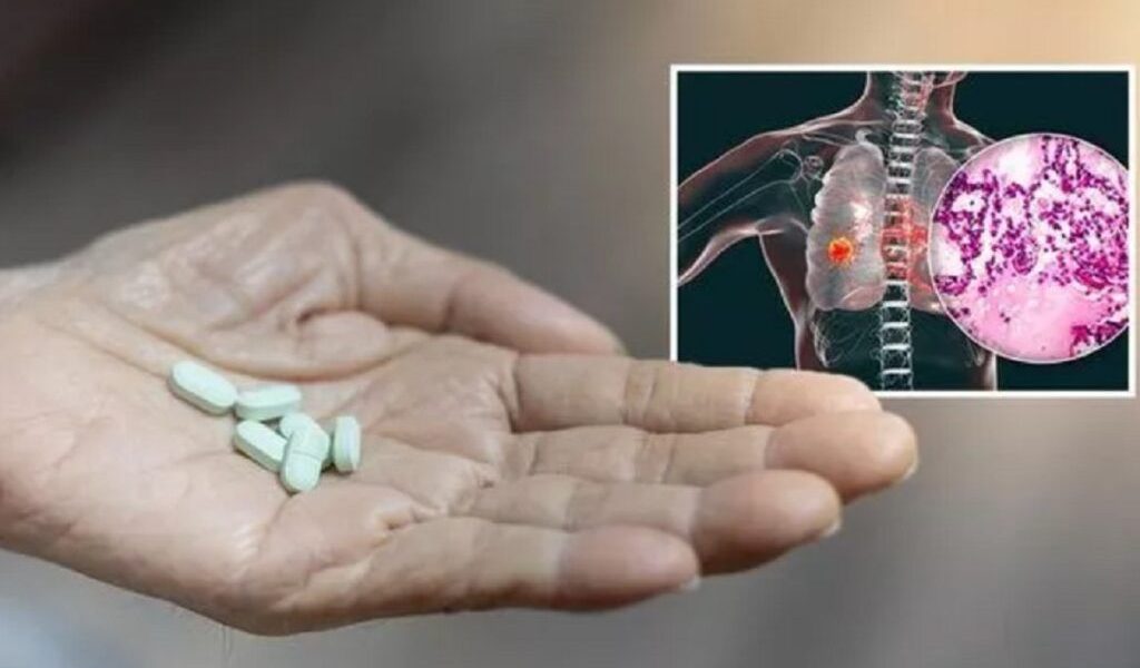 Atenție la combinațiile de suplimente alimentare: Ce spun specialiștii Un număr tot mai mare de români apelează la suplimente alimentare, fie pentru a-și spori nivelul de energie, fie pentru a-și întări sistemul imunitar