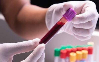 Alertă medicală: Nivelul de dioxid de carbon din sânge, în creștere alarmantă Un studiu australian recent a scos la iveală date îngrijorătoare referitoare la creșterea nivelului de dioxid de carbon (CO2) în sângele uman