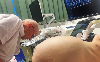 Tumoră gigantă, de 25 de kilograme, extirpată cu succes la Cluj-Napoca O echipă medicală de la Spitalul Clinic Județean de Urgență Cluj-Napoca a realizat o intervenție chirurgicală complexă pentru îndepărtarea unei tumori gigantice, de natură lipomatoasă, de la un pacient în vârstă de 71 de ani