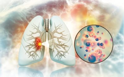 Legătura șocantă: Cancerul pulmonar la nefumători, din cauza unor alimente?