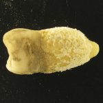 Bacteria scarlatinei, în MUMIE PRECOLUMBIANĂ: Misterul vechii lumi dezvăluit