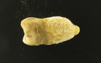 Bacteria scarlatinei, în MUMIE PRECOLUMBIANĂ: Misterul vechii lumi dezvăluit