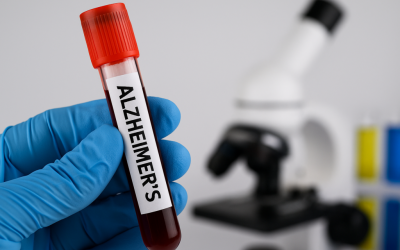 Un test de sânge simplu promite să revoluționeze depistarea demenței, oferind posibilitatea identificării riscului de dezvoltare a acestei afecțiuni cu zeci de ani înainte de apariția primelor simptome