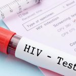 Bărbat din SUA, vindecat de HIV fără medicamente, o premieră medicală!