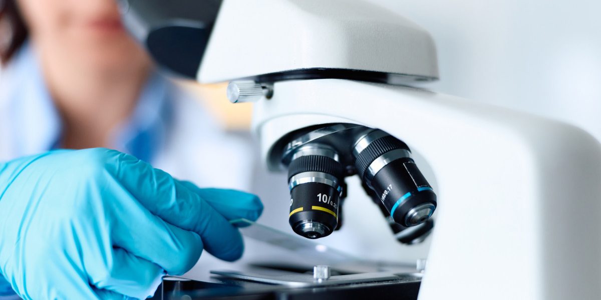 Secretul lui Parkinson: O descoperire vitală în celulele nervoase schimbă tot