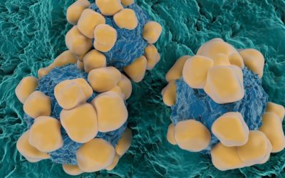 Oamenii de știință au dezvoltat senzori extrem de mici, cu dimensiunea unui fir de păr, care au potențialul de a revoluționa detectarea și monitorizarea cancerului