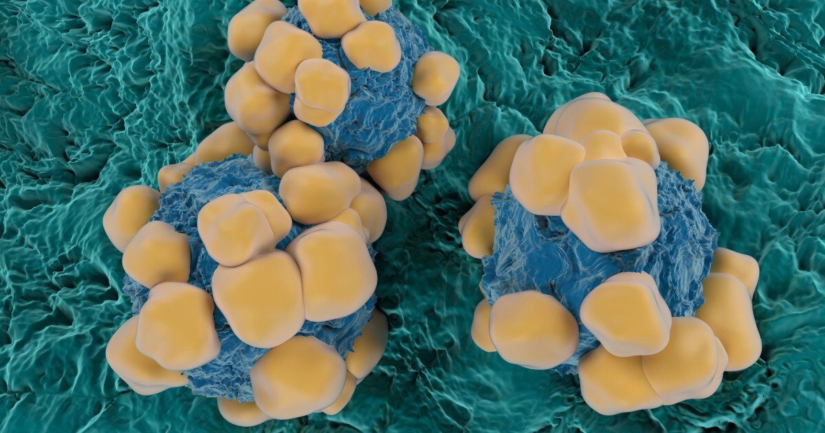 Oamenii de știință au dezvoltat senzori extrem de mici, cu dimensiunea unui fir de păr, care au potențialul de a revoluționa detectarea și monitorizarea cancerului