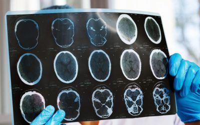 Scădere dramatică a investigațiilor medicale pentru pacienții cronici: Asociațiile cer intervenția urgentă a Ministerului Sănătății București – Accesul pacienților cronici la investigațiile medicale de înaltă performanță este grav afectat de noile reguli de decontare intrate în vigoare la începutul acestui an, potrivit reprezentanților asociațiilor de pacienți