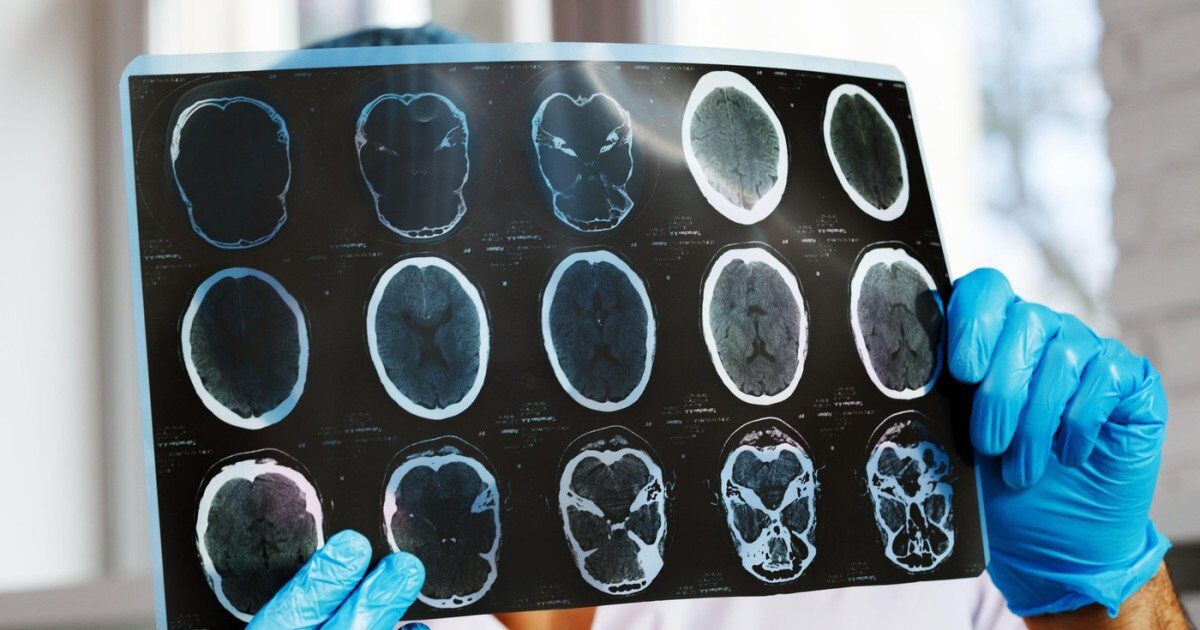 Scădere dramatică a investigațiilor medicale pentru pacienții cronici: Asociațiile cer intervenția urgentă a Ministerului Sănătății București – Accesul pacienților cronici la investigațiile medicale de înaltă performanță este grav afectat de noile reguli de decontare intrate în vigoare la începutul acestui an, potrivit reprezentanților asociațiilor de pacienți