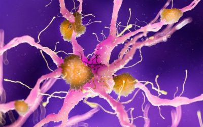 Boala Alzheimer: O nouă perspectivă asupra originii sale, care ar putea schimba abordarea tratamentului Un studiu recent, realizat pe un eșantion vast de pacienți, sugerează o schimbare majoră de paradigmă în ceea ce privește boala Alzheimer