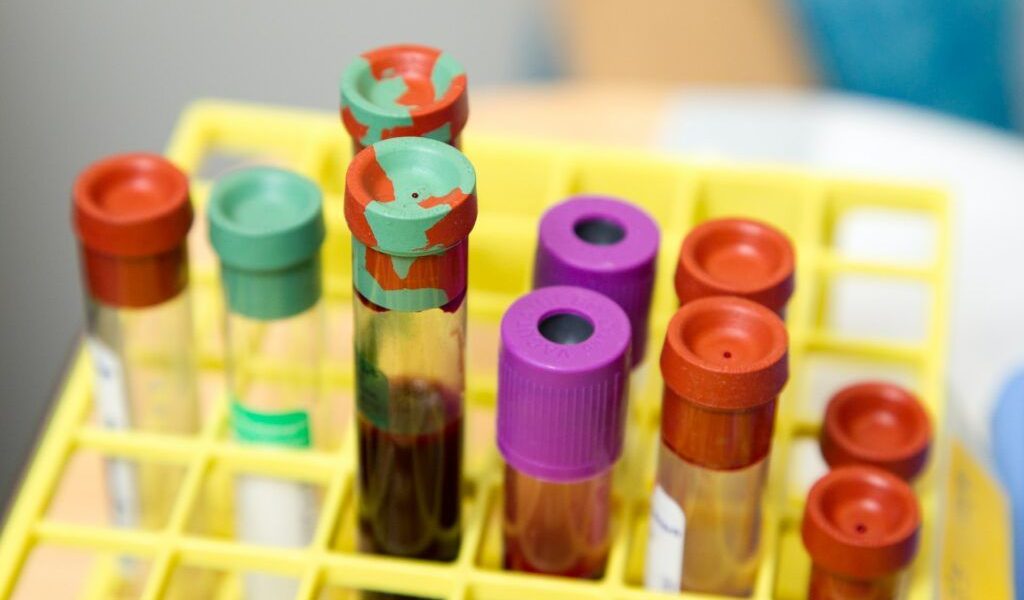 Ce costă analizele în 2026 pentru cei fără asigurare: Diferența e URIAȘĂ!