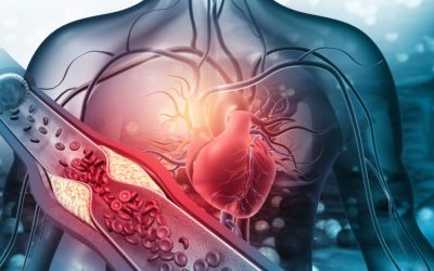 Atenție: Alimentul-minune care curăță arterele și previne AVC-ul, dezvăluirea unui medic