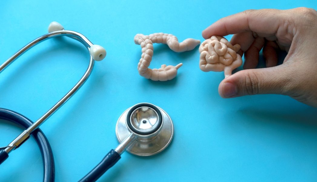 De ce cancerul de colon lovește tot mai mulți tineri în întreaga lume?