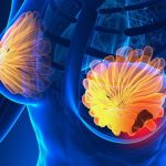 Semnele cancerului de sân: 5 simptome cruciale la care să fii atentă