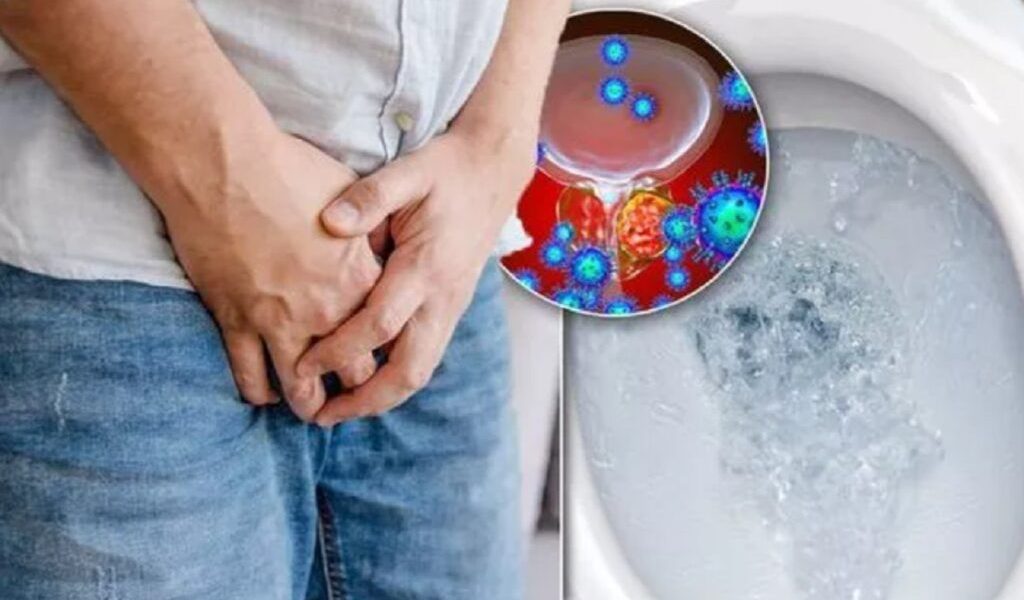 Cancerul „tăcut” ucide bărbații: 3 semne ignorate. Poți scăpa de moarte