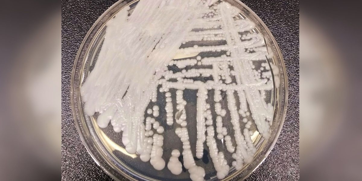 Candida Auris în România: Cum se oprește răspândirea acestei ciuperci periculoase