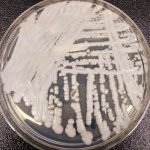 Candida Auris în România: Cum se oprește răspândirea acestei ciuperci periculoase