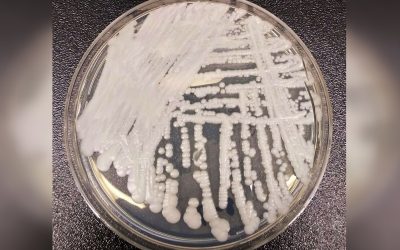 Candida Auris în România: Cum se oprește răspândirea acestei ciuperci periculoase