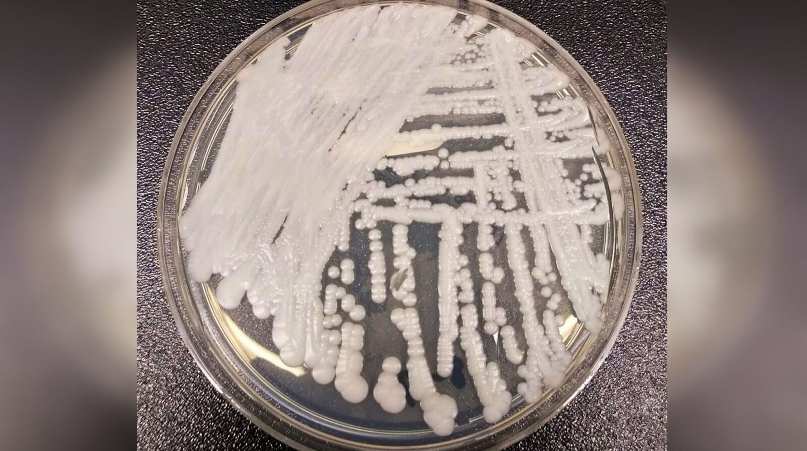 Candida Auris în România: Cum se oprește răspândirea acestei ciuperci periculoase